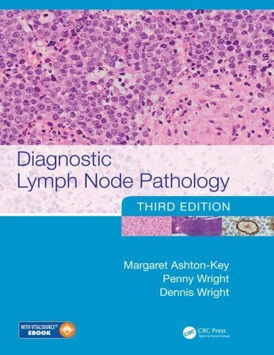 Diagnostic Lymph Node Pathology 3Rd Edition