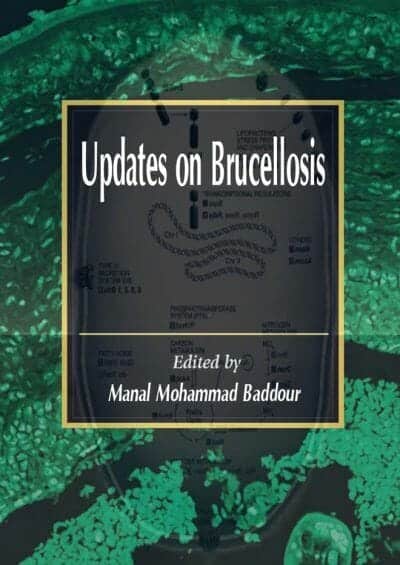 Updates On Brucellosis