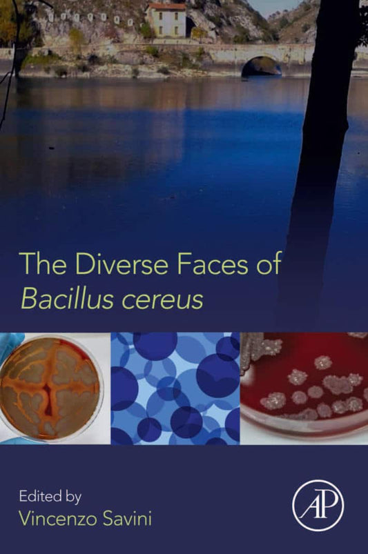 The Diverse Faces Of Bacillus Cereus