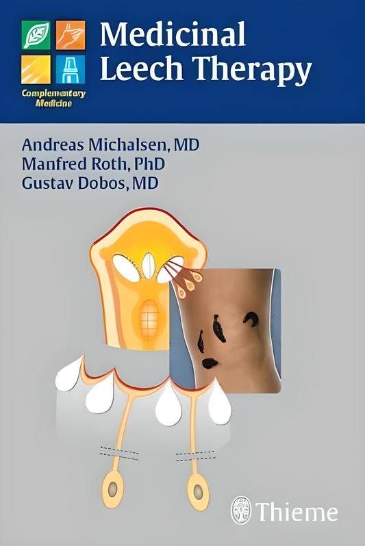 Medicinal Leech Therapy - HD Cover