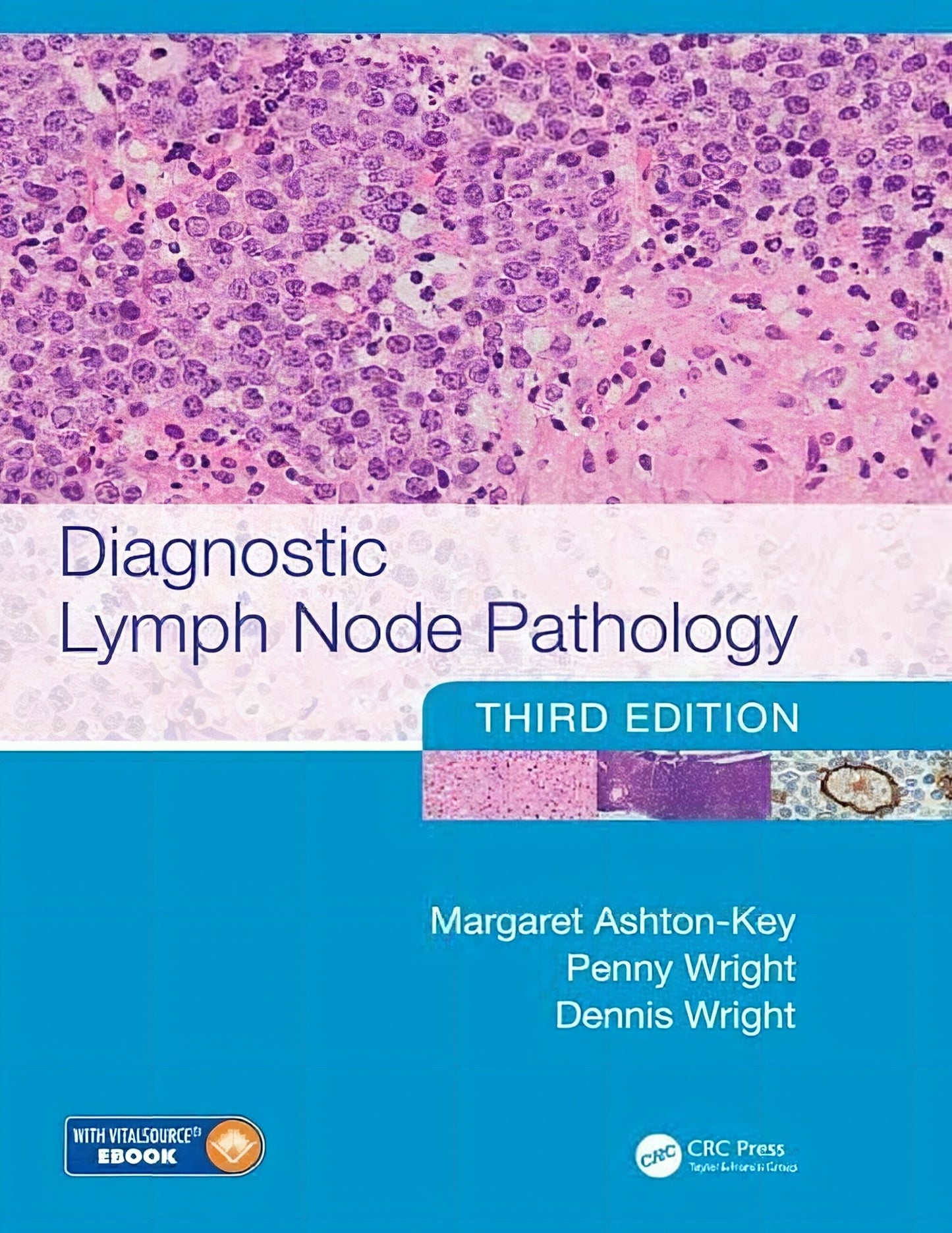 Diagnostic Lymph Node Pathology 3Rd Edition