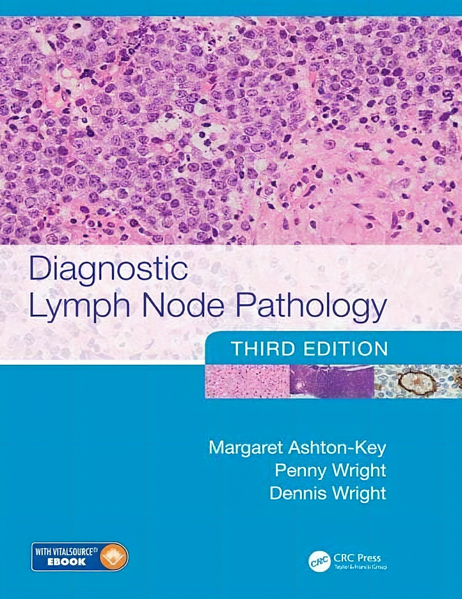 Diagnostic Lymph Node Pathology 3Rd Edition