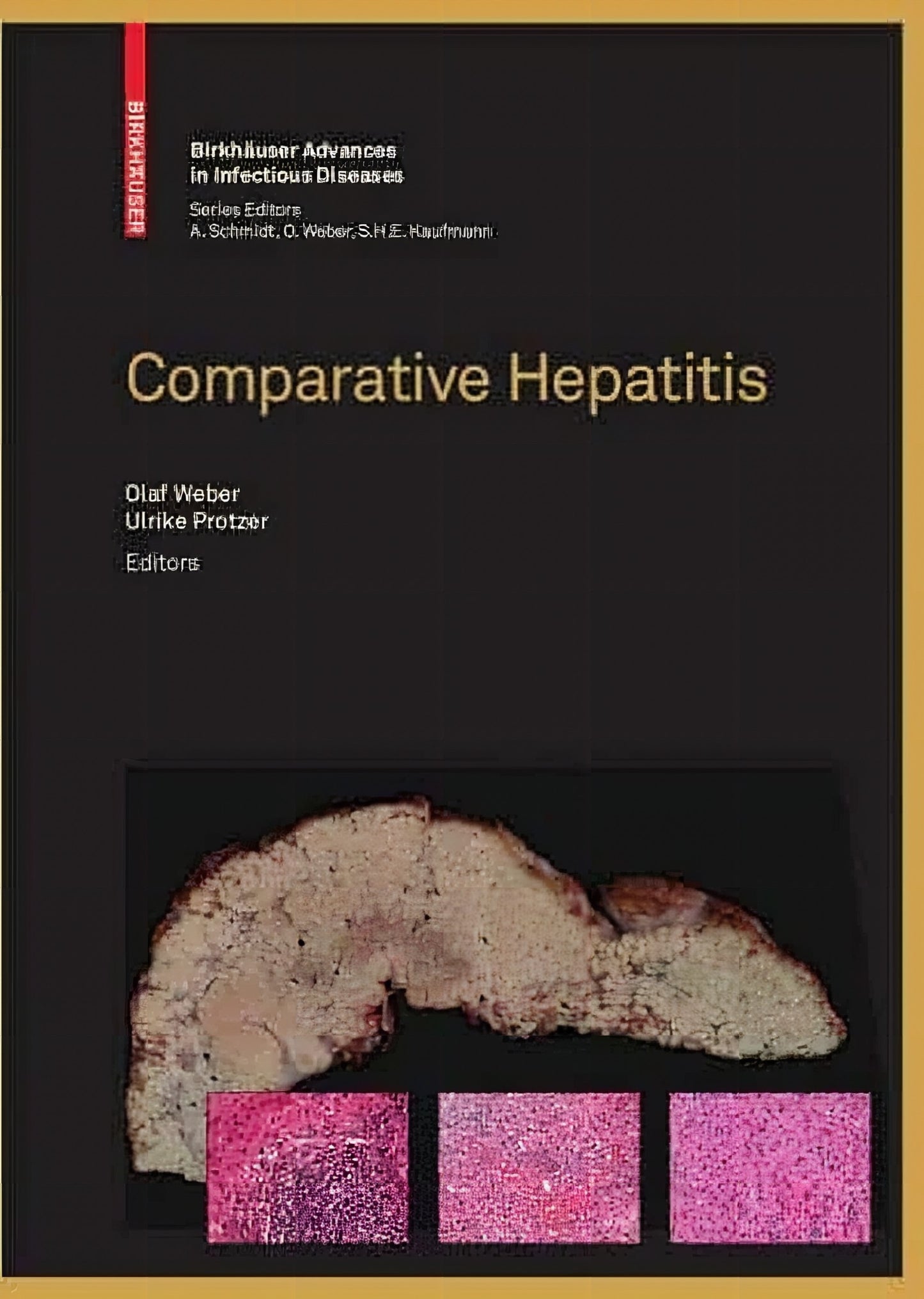 Comparative Hepatitis Birkhauser Advances In Infectious Diseases