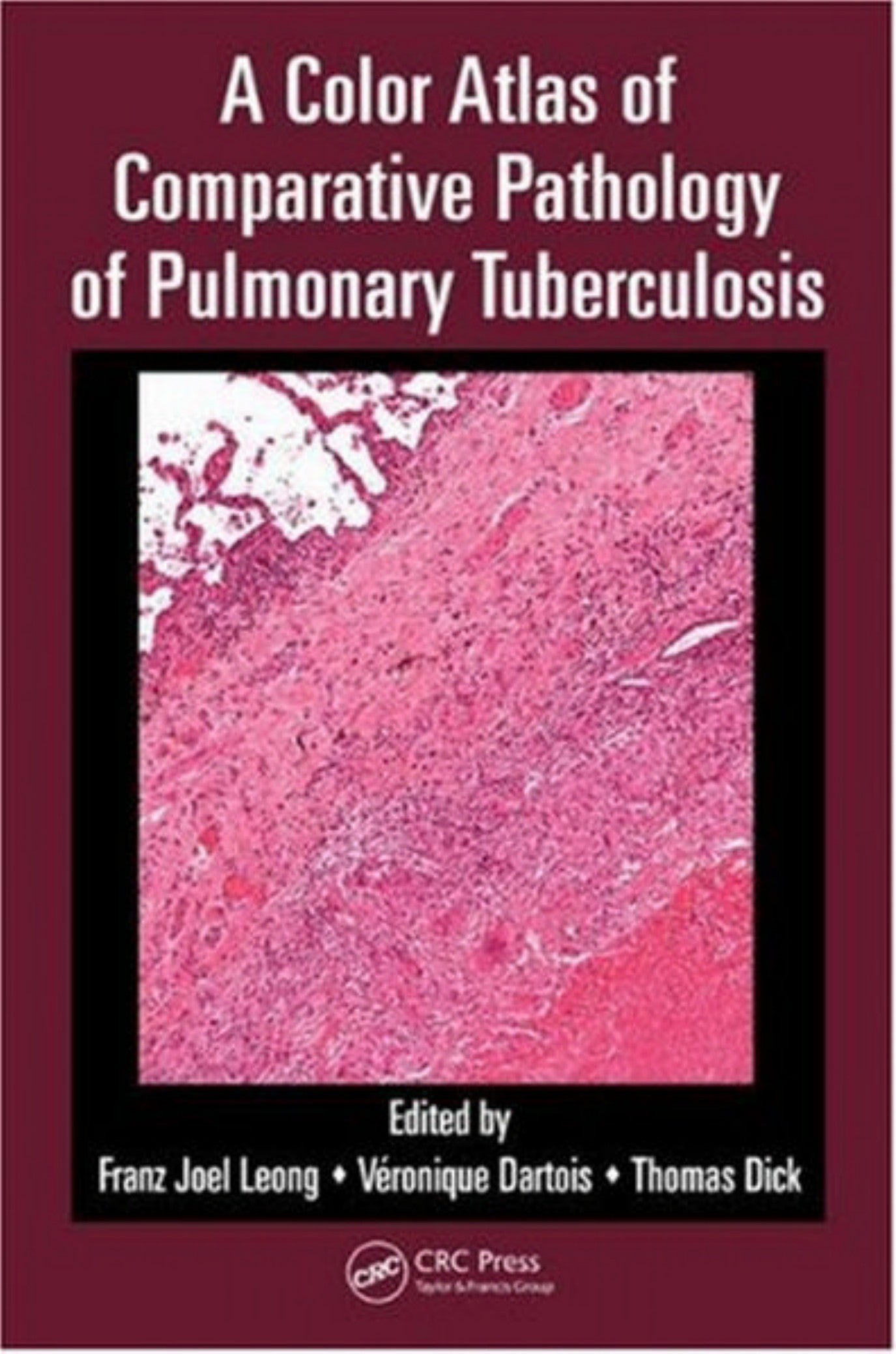 A Color Atlas Of Comparative Pathology Of Pulmonary Tuberculosis