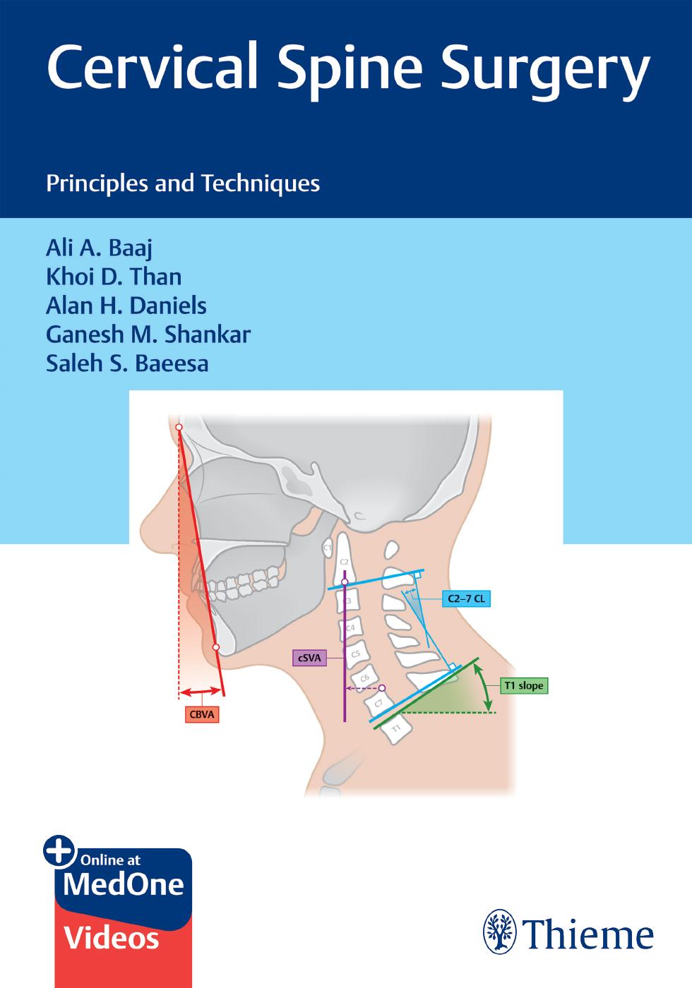 Cervical Spine Surgery: Principles and Techniques