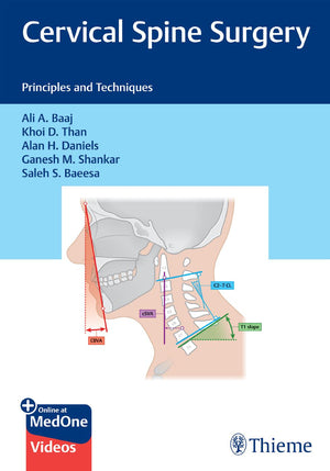 Cervical Spine Surgery: Principles and Techniques
