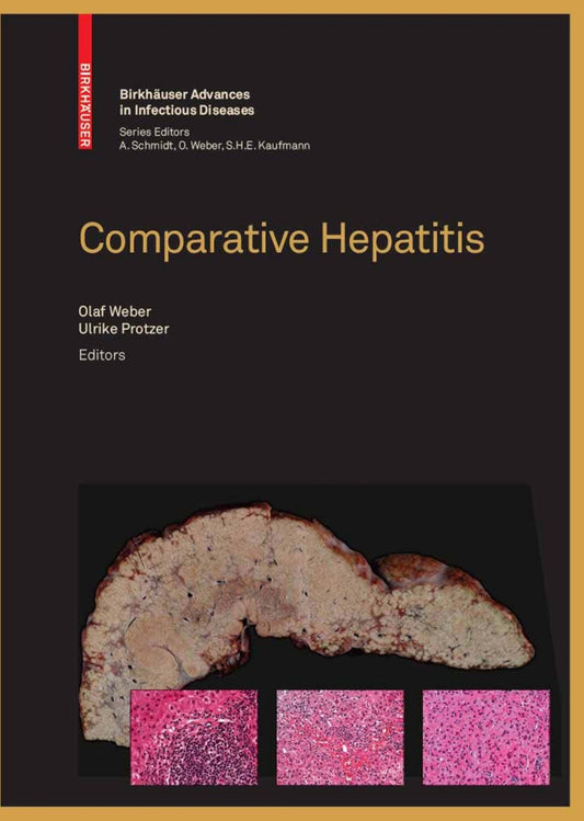 Comparative Hepatitis Birkhauser Advances In Infectious Diseases