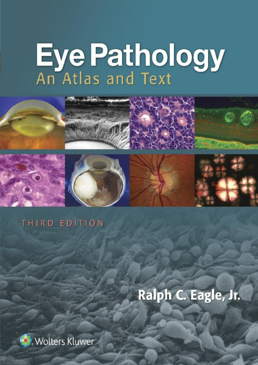 Eye Pathology: An Atlas and Text 3rd Edition