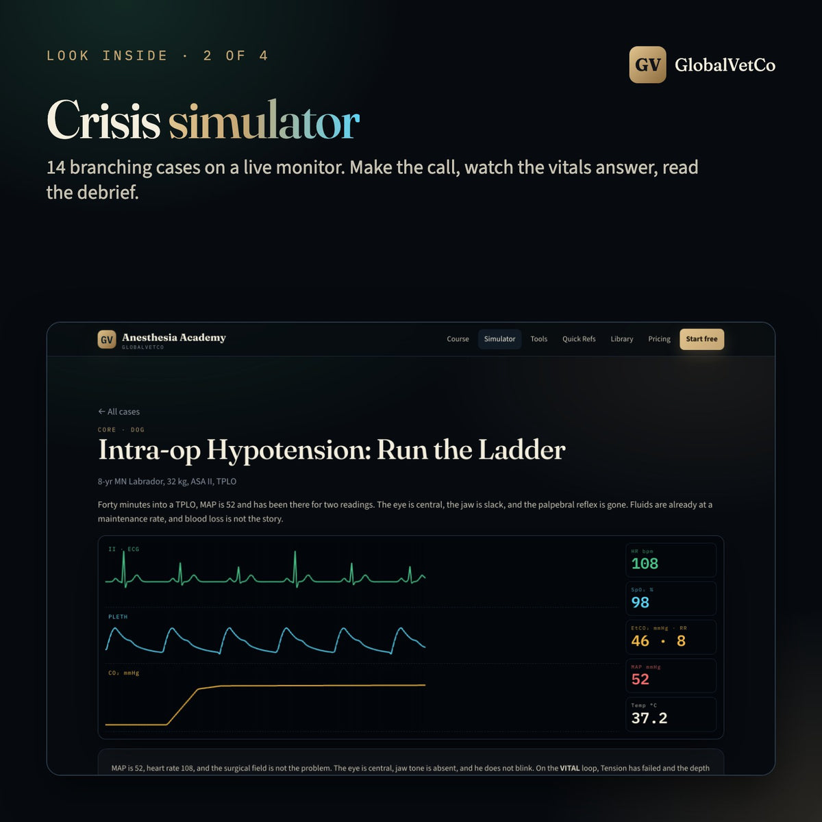 Look inside: branching crisis simulator on a live patient monitor