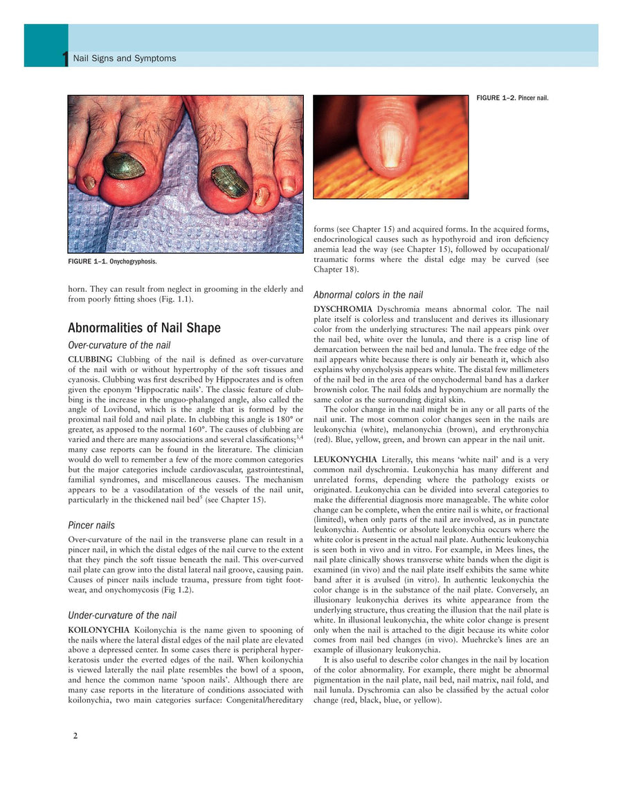 Preview page of Nails: Diagnosis, Therapy, Surgery