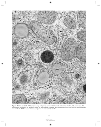 Ultrastructural Pathology the Comparative Cellular Basis of Disease 2nd Edition