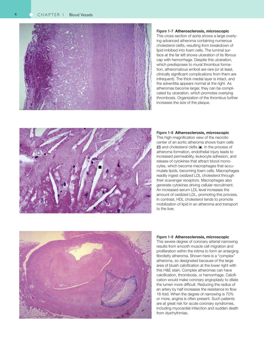 Preview page of Robbins and Cotran Atlas of Pathology 3rd Edition