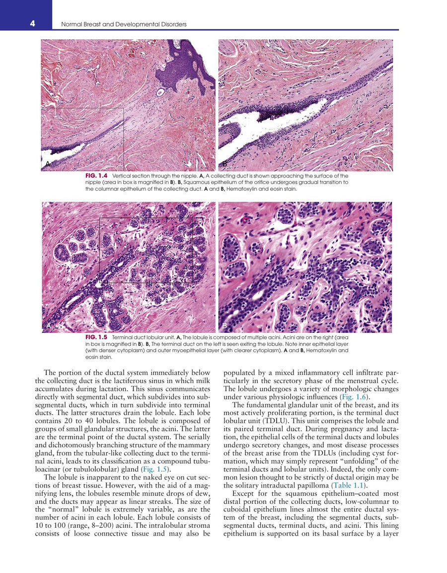 Preview page of Breast Pathology 2nd Edition