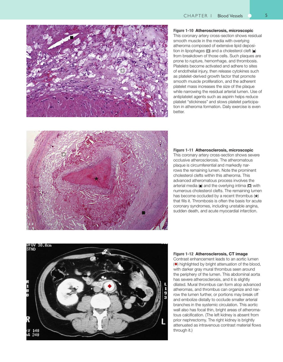 Preview page of Robbins and Cotran Atlas of Pathology 3rd Edition