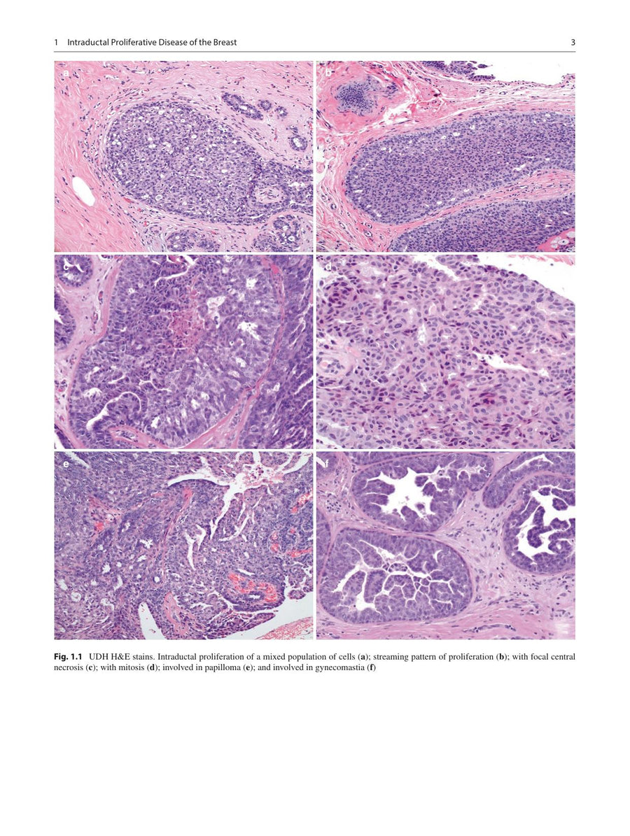 Preview page of Practical Breast Pathology: Frequently Asked Questions