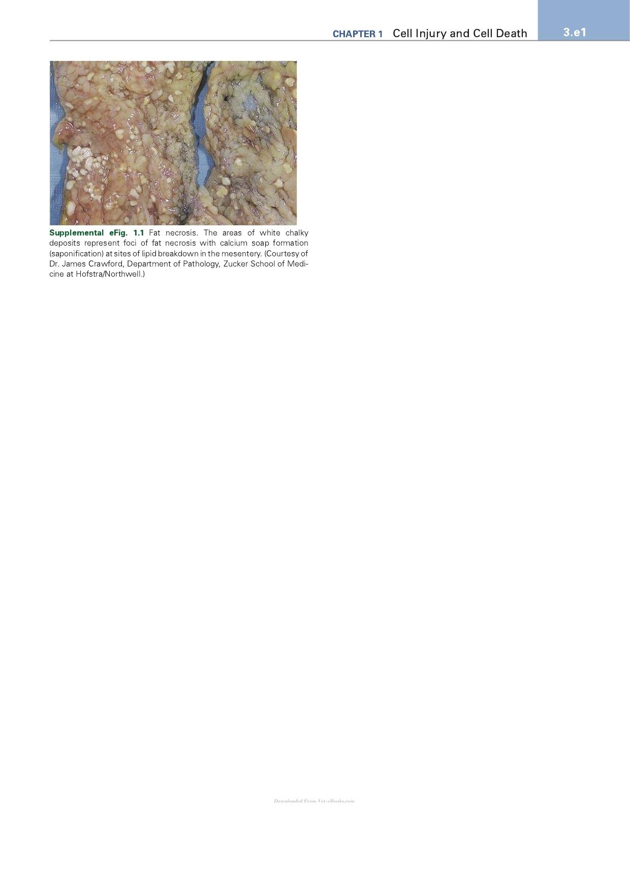 Robbins Essential Pathology