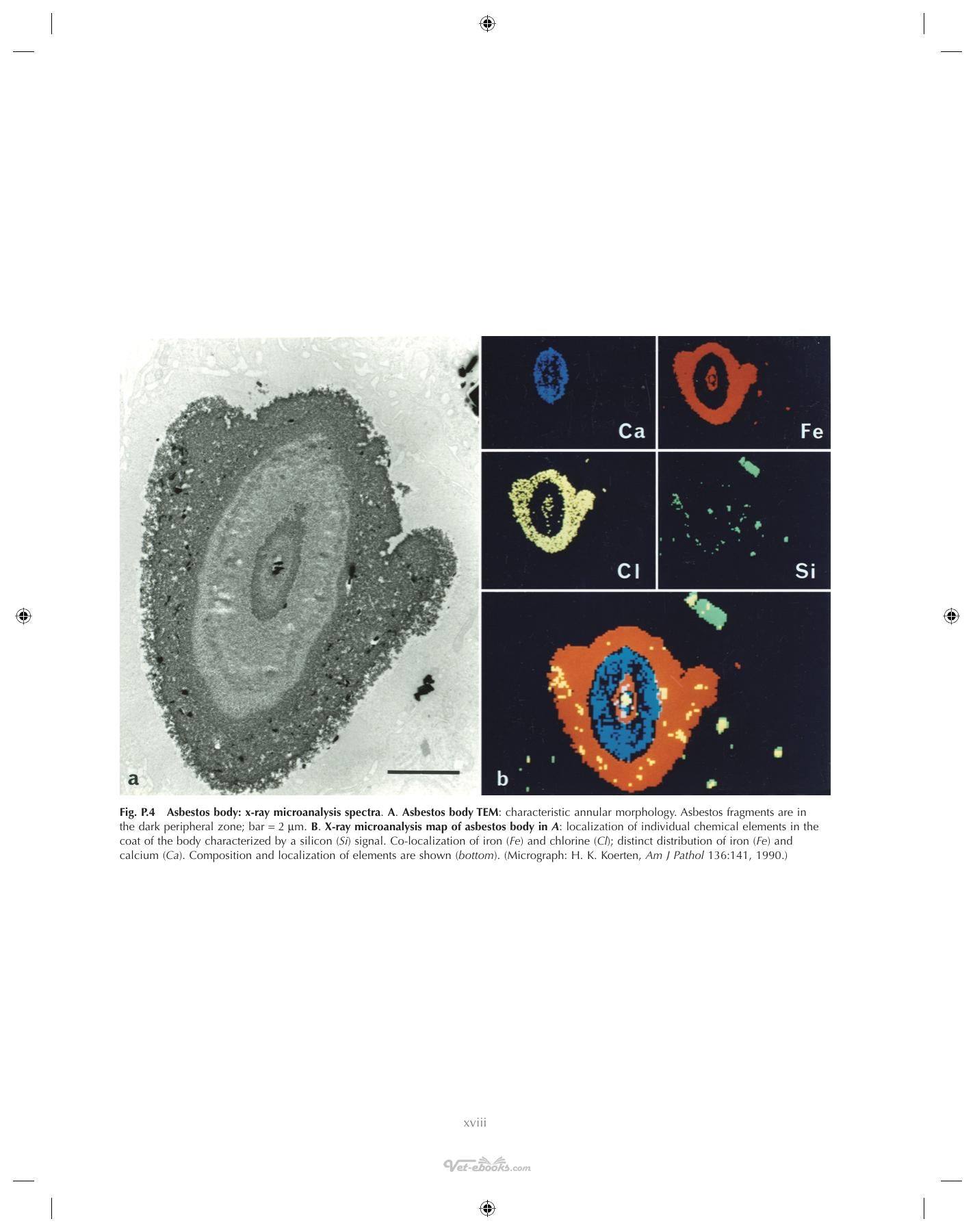 Ultrastructural Pathology The Comparative Cellular Basis Of Disease 2Nd Edition