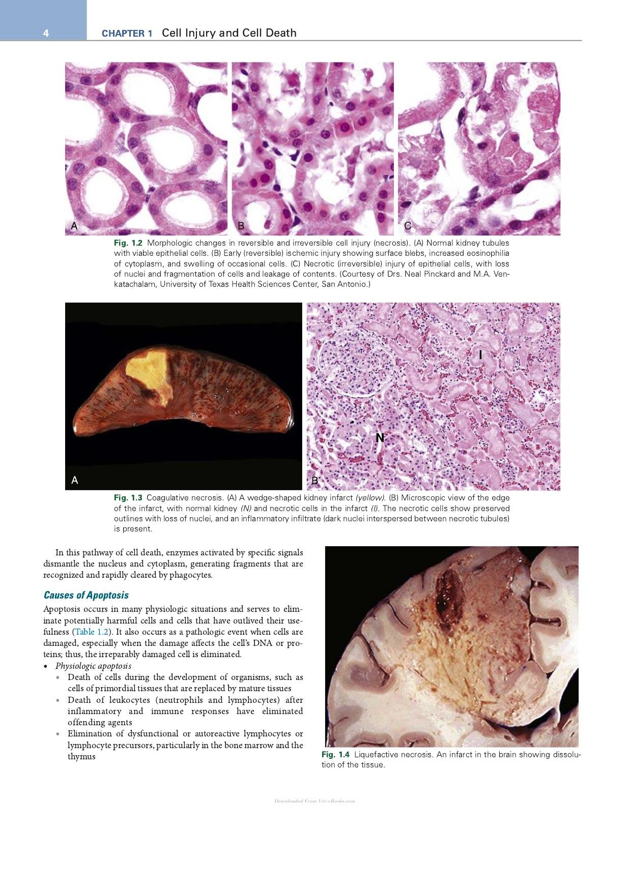 Robbins Essential Pathology