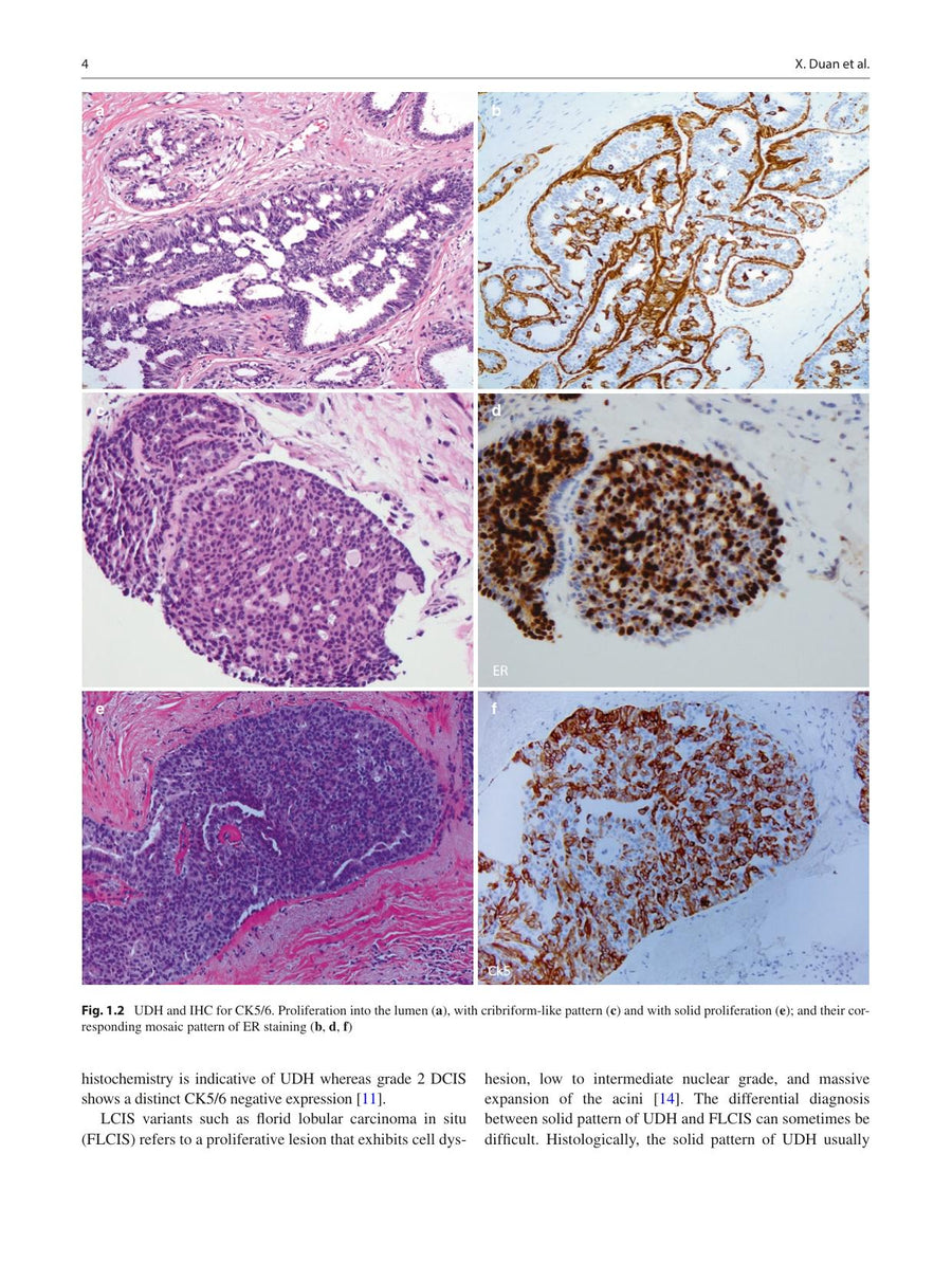 Preview page of Practical Breast Pathology: Frequently Asked Questions