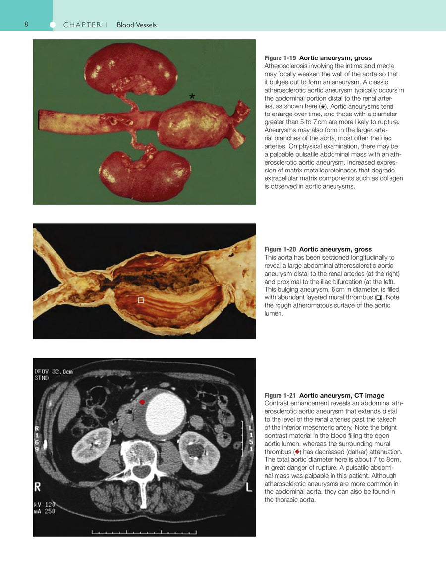 Preview page of Robbins and Cotran Atlas of Pathology 3rd Edition