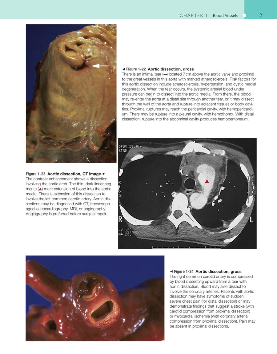 Preview page of Robbins and Cotran Atlas of Pathology 3rd Edition