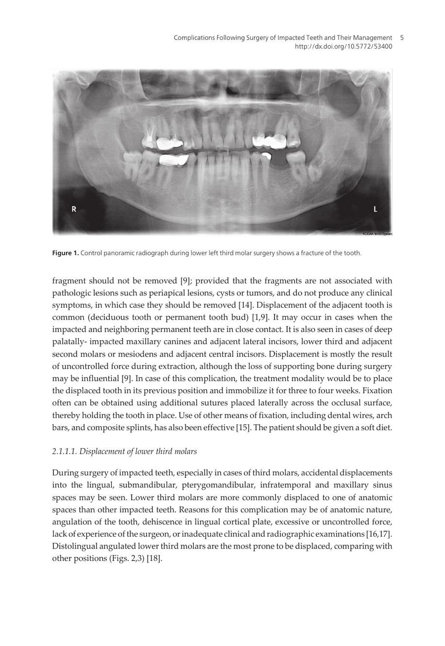Preview page of A Textbook of Advanced Oral and Maxillofacial Surgery