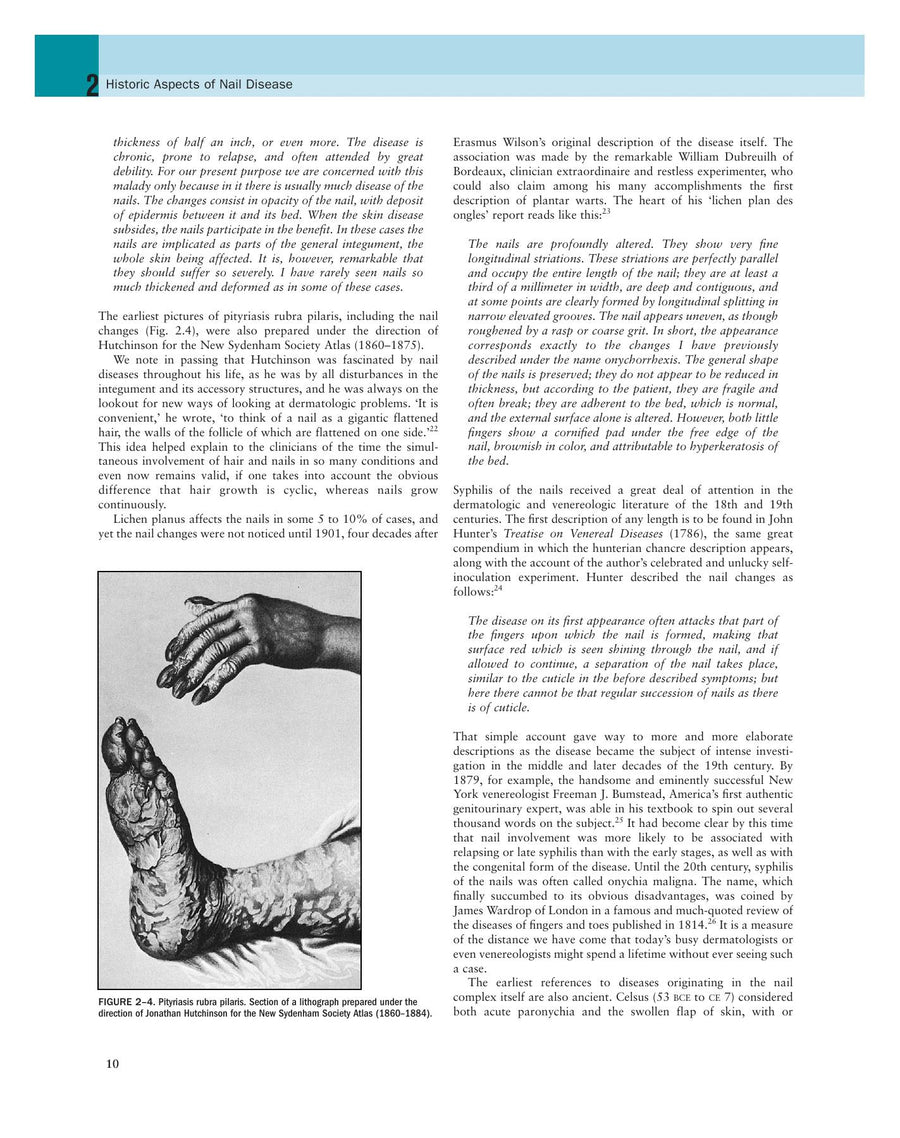 Preview page of Nails: Diagnosis, Therapy, Surgery