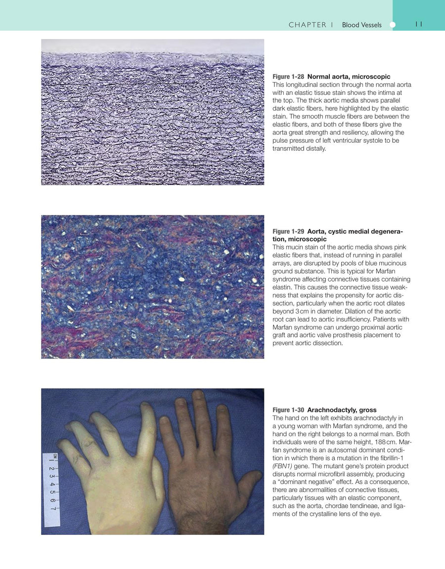 Preview page of Robbins and Cotran Atlas of Pathology 3rd Edition