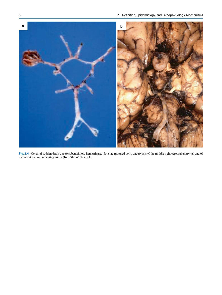 Preview page of Sudden Cardiac Death in the Young and Athletes: Text Atlas of Pathology and Clinical Correlates