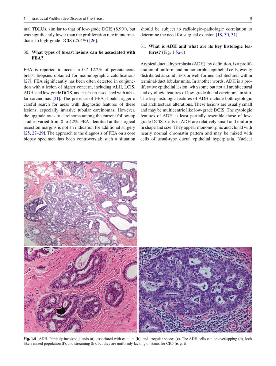 Preview page of Practical Breast Pathology: Frequently Asked Questions