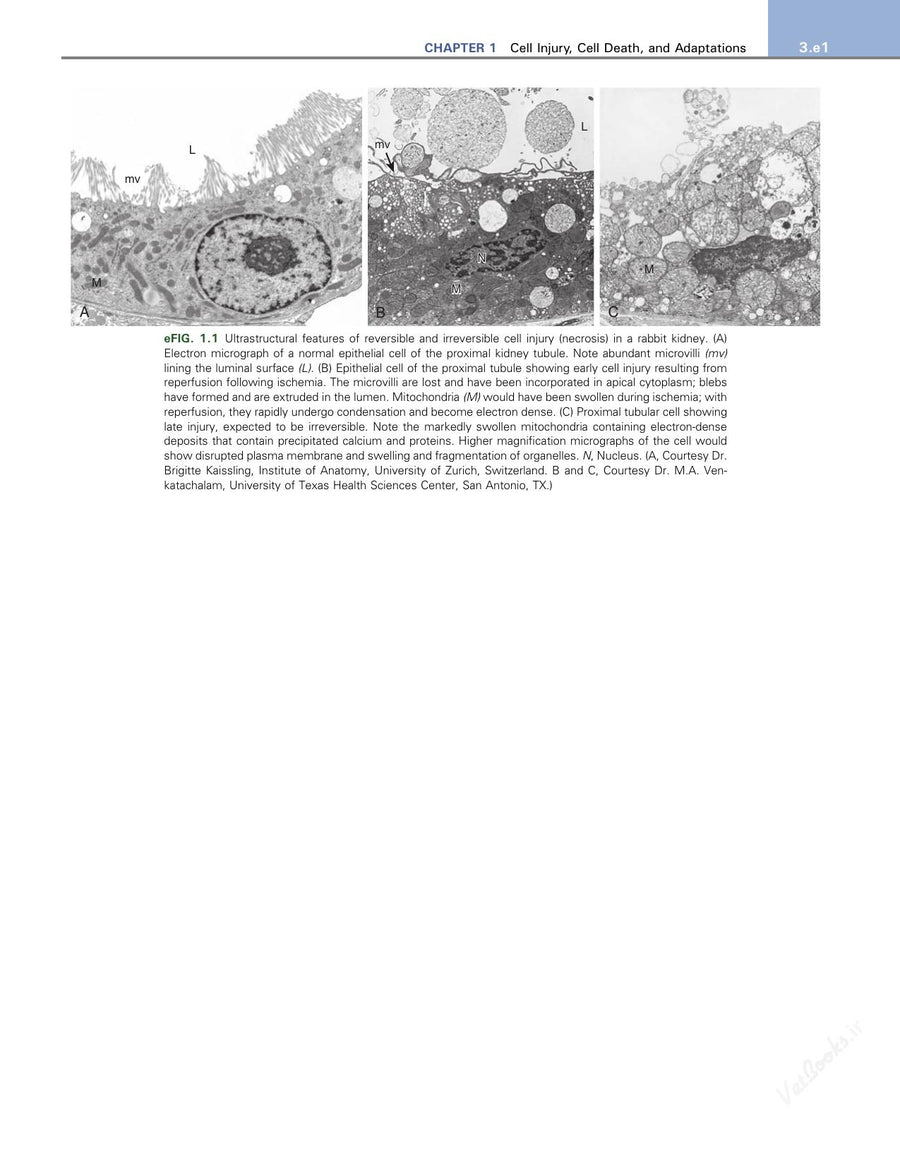 Preview page of Robbins & Kumar Basic Pathology 11th Edition
