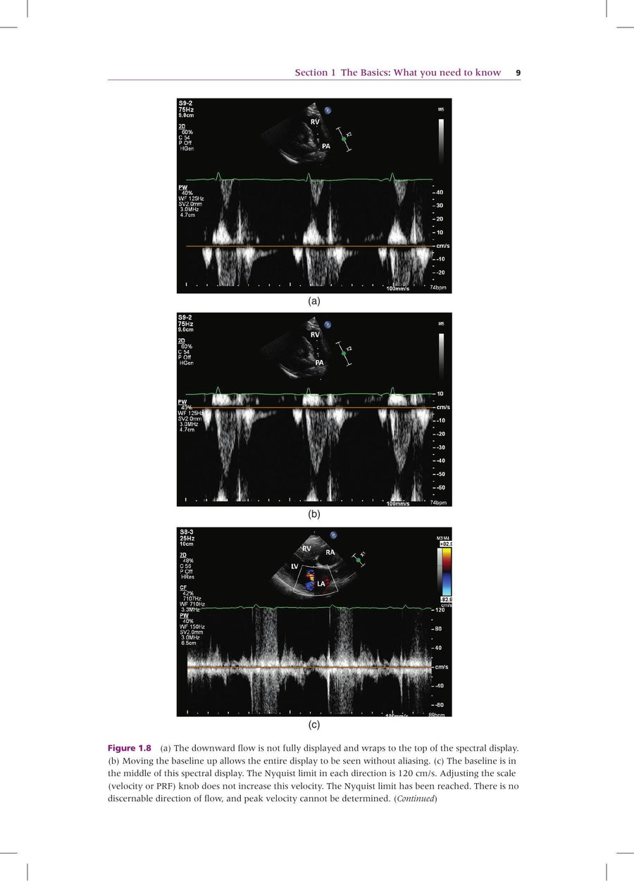 Preview page of Doppler Echocardiography for the Small Animal Practitioner