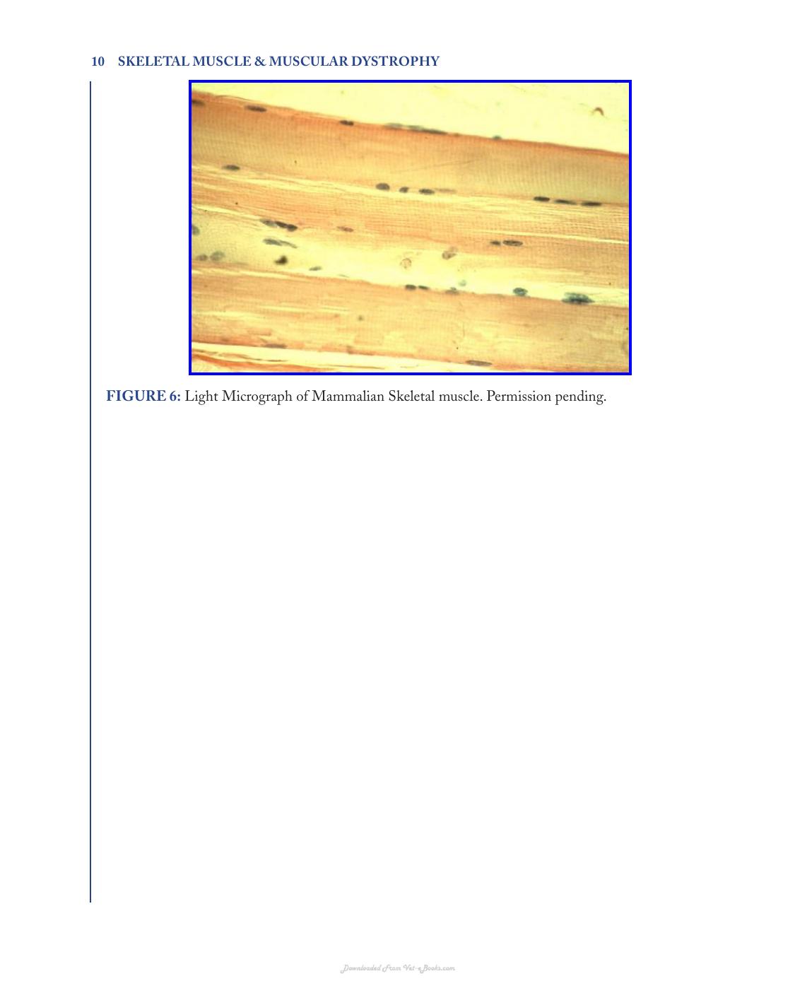 Skeletal Muscle and Muscular Dystrophy a Visual Approach