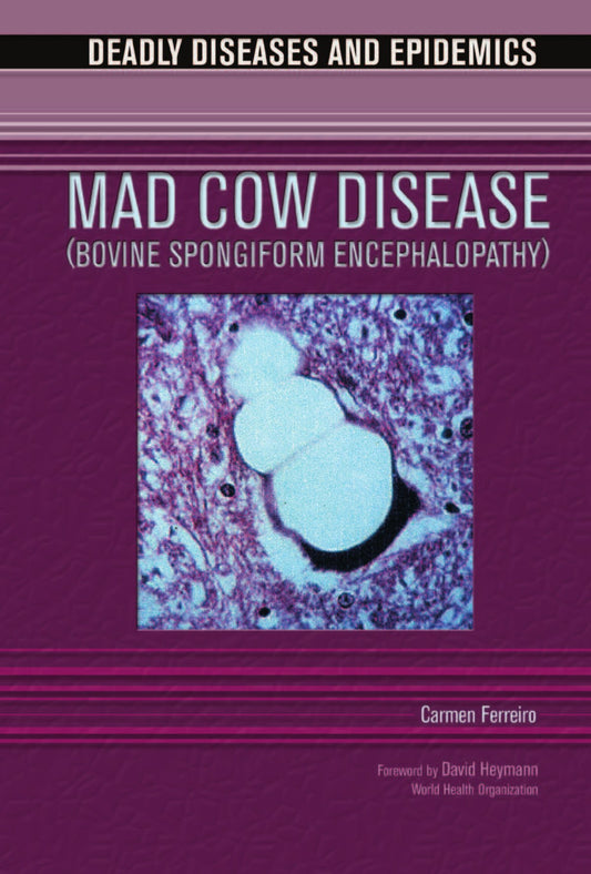 Mad Cow Disease Bovine Spongiform Encephalopathy