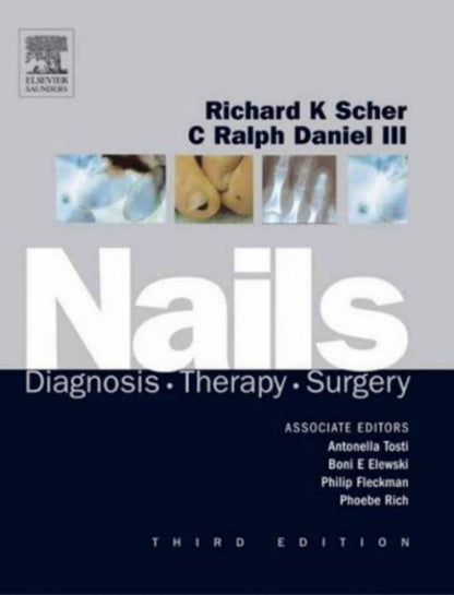 Nails: Diagnosis, Therapy, Surgery