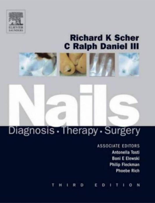 Nails: Diagnosis, Therapy, Surgery