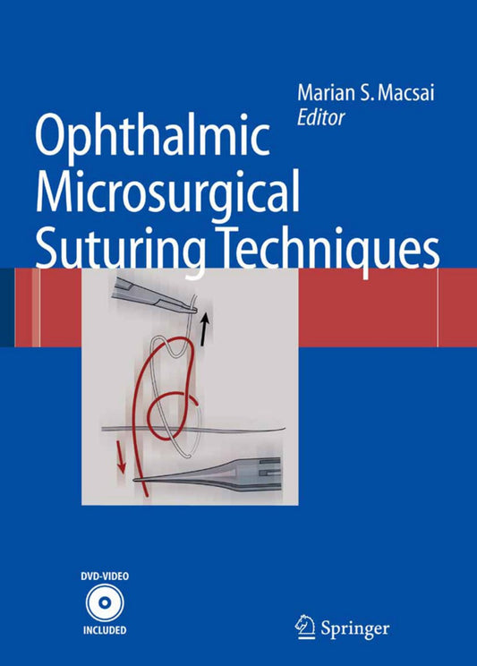 Ophthalmic Microsurgical Suturing Techniques