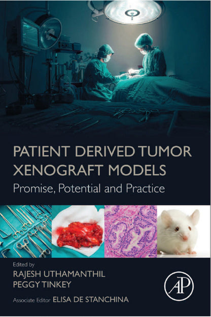 Patient Derived Tumor Xenograft Models Promise Potential And Practice