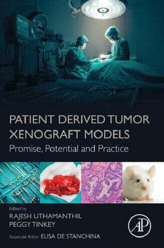 Patient Derived Tumor Xenograft Models Promise Potential And Practice