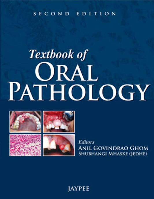 Textbook of Oral Pathology 2nd Edition